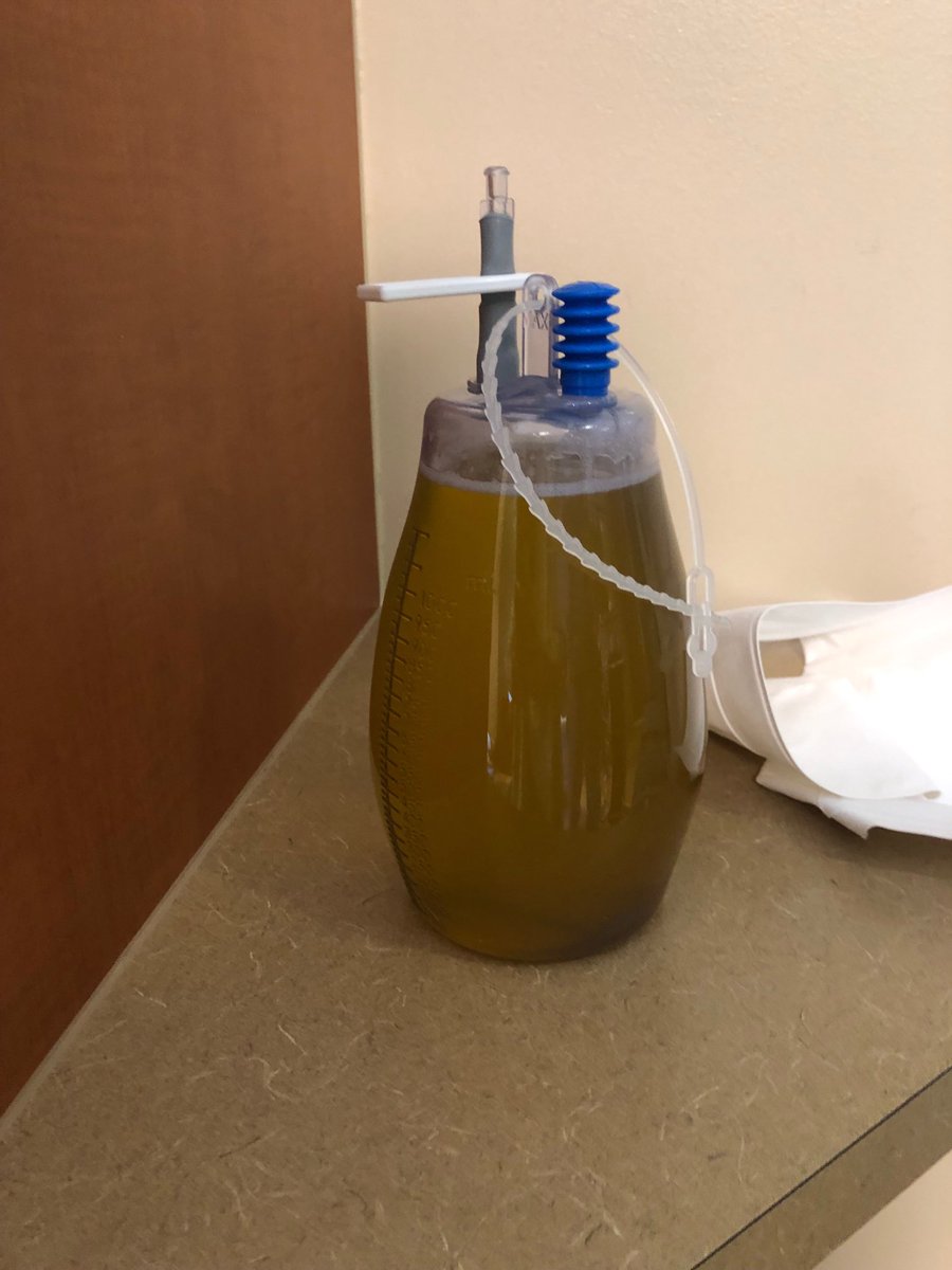 superdaveoz45's tweet photo. This is fluid out of my right lung. 1 1/2litres. https://t.co/D07jpRqcRQ