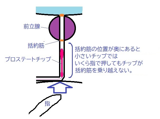 まなか牛乳 On Twitter 小さいプロステートチップだと前立腺位置が奥にある人は挿入が難しいです 解決方法は主に3つ チップを長くする 補助チップをつける 括約筋が自然に手前に来るのを待つ 括約筋位置が動かない人は不可能 以上の理由で私は
