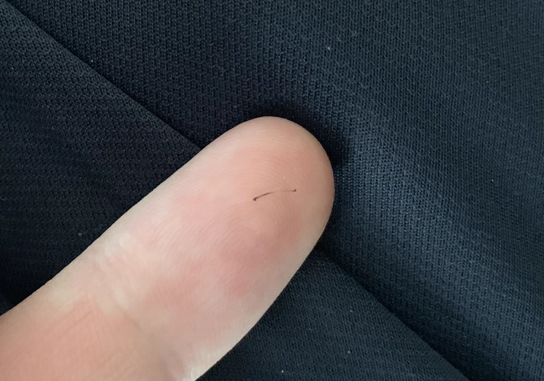 @NazologyInfo 髪の毛ではなくて頬にあった毛なのですがこういうのよくあります 