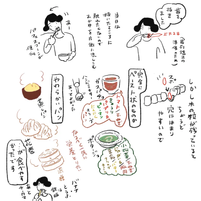 最近の歯日記 