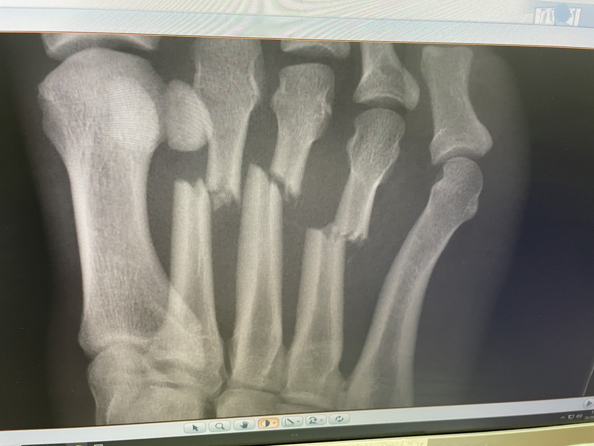 Ieuan Hewitt tweet media