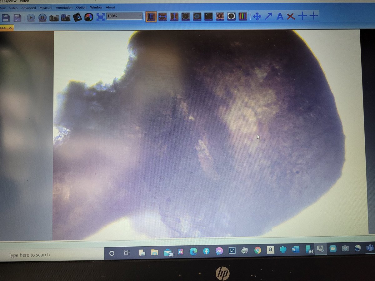 I wonder who can guess what this is? (Apart from a slightly fuzzy image taken by phone from laptop screen of a slide sample!)