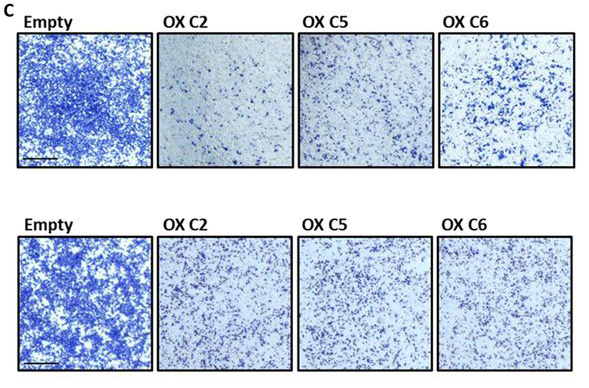 ScienceMagazine: Breast cancer cells fuel their invasiveness by suppressing a gene named TSHZ2, which acts as a key brake in cell division. Check out the new analysis in <a href="/SciSignal/">Science Signaling</a> of cells and data from patients with #BreastCancer. …