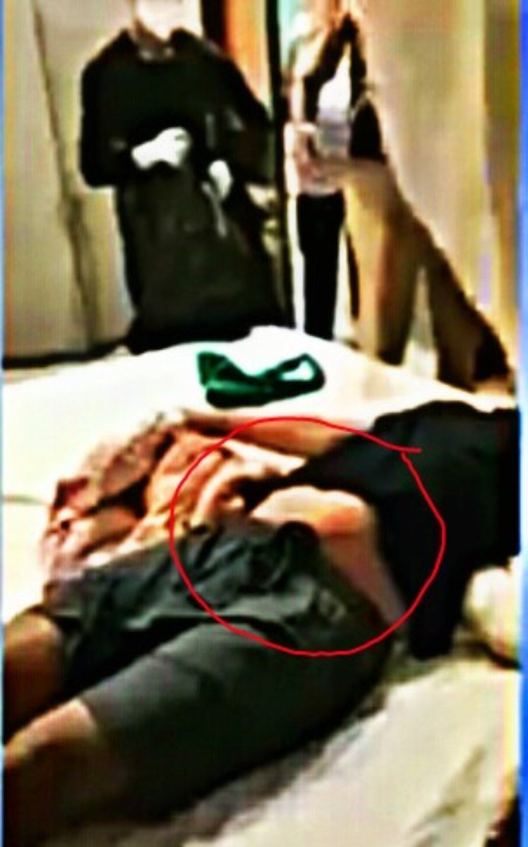 sumidas198's tweet photo. 🔸Legs broken
🔸hands stretch
🔸partial eyes open 
🔸stun gun &amp; needle marks on neck
🔸'O' shaped ligature 
🔸bruises on face
🔸deep cut mark on abdomen

How can all these happen due to a Suicide ⁉️
 @ips_nupurprasad @PMOIndia
CBI Who Killed Sushant
 https://t.co/dGQAwc2pEK
