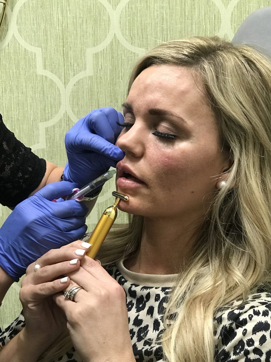Bulging is an interesting and weird occurrence- yet not surprising after manipulating such sensitive parts of the face (basically anywhere in the face)In the pictures attached, there is a noticeable similarity (almost identical) to the lumps on Heard& #39;s foread & the patient.