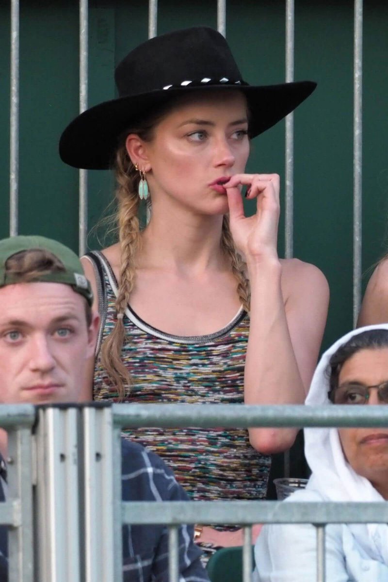 Though injections are HIGHLY suspected, there are notes Amber Heard has a problem picking at her dry lips- the drying is said to be due to certain prescriptions she's been taking (specifically Accutane for acne). Picking at chapped lips does lead to bleeding.