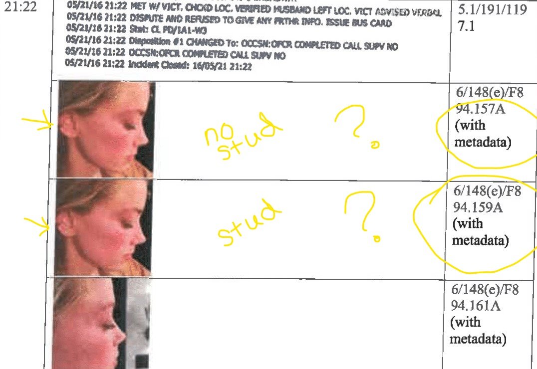 2/2 From the other POV *enhanced to see the red mark on face, strangely "naturally" contoured cheekbones, what looks like a bruise around the hairline, odd discoloration near eyebrow, chapped lips, same upper earing. Metadata inconsistent with stud earring there/not there. & hoax