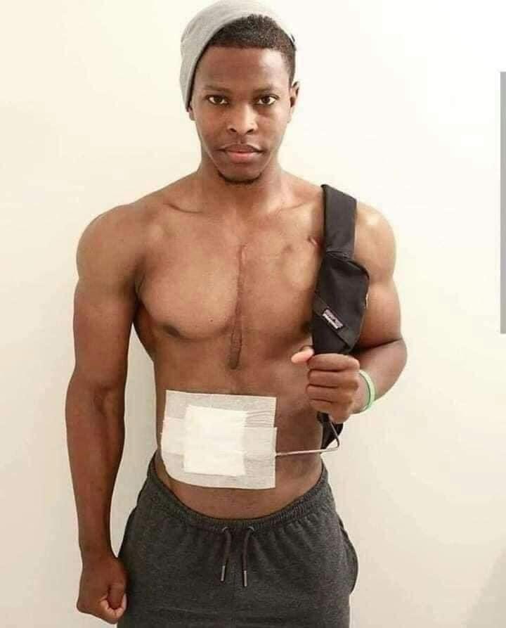 dammiedammie35's tweet photo. Meet 28 year old Andrew Jones, the man lives his life with an artificial heart in his bag 💪 https://t.co/Fn6BdzhYtG
