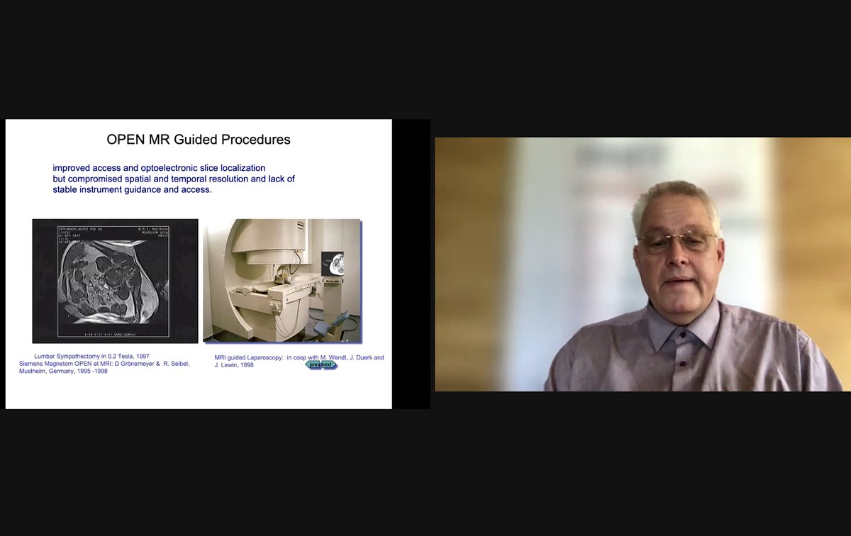 ICLHamlynRobots's tweet image. Prof. Andreas Melzer is now giving a talk about applying #Robotics for #ImageGuided therapy &amp;amp; FUS at the 'Towards #Robotic Autonomy In #Surgery' workshop #HSMR21. @ICLHamlynRobots

#Imaging #UltraSound #Kinematics #CTGuided #Robotics

Join us now👉bit.ly/HSMR21-WS-2