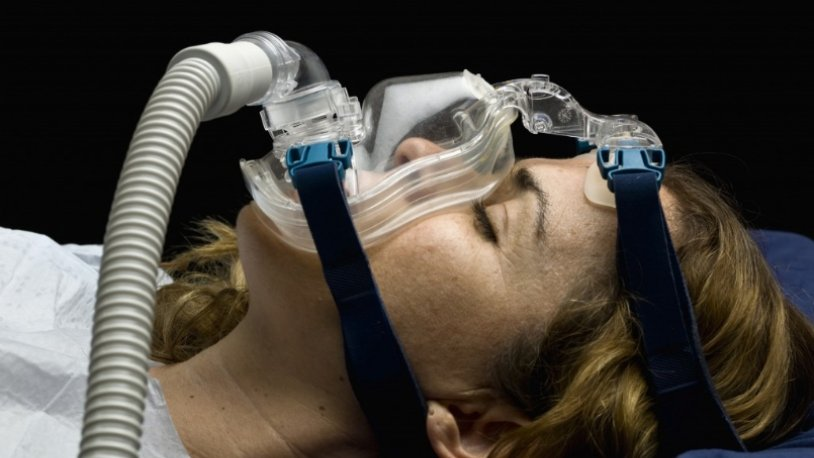 девушки в реанимации под аппаратом. аппарат ивл после операции. неинвазивный ивл аппарат. ивл женщина. девушка в кислородной маске в больнице.