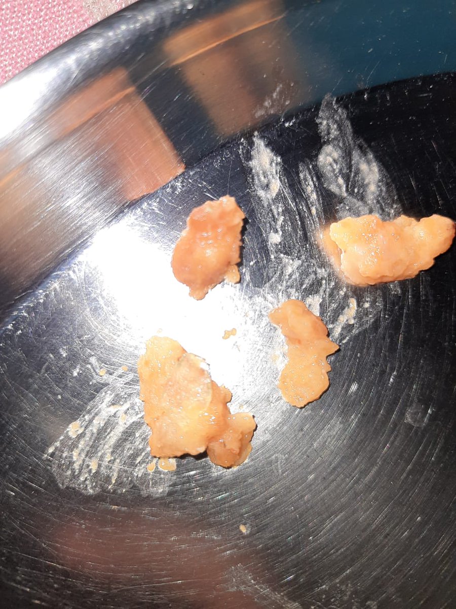 supriya bhatt (@supriyabhatt8) on Twitter photo <a href="/McCainFoodsInd/">McCain Foods India</a> <a href="/amazonIN/">Amazon India</a> <a href="/fssaiindia/">FSSAI</a> I hv ordrd mccains cheese samosa frm Amazon n used it t'day n guess wht my mother found a piece of glass while eating it.Wht r the safety measures you guys r taking?Wht if smthn hapns to my mother? I am going to file case against ur company <a href="/McCainFoodsInd/">McCain Foods India</a> <a href="/amazonIN/">Amazon India</a> <a href="/fssaiindia/">FSSAI</a> I hv ordrd mccains cheese samosa frm Amazon n used it t'day n guess wht my mother found a piece of glass while eating it.Wht r the safety measures you guys r taking?Wht if smthn hapns to my mother? I am going to file case against ur company