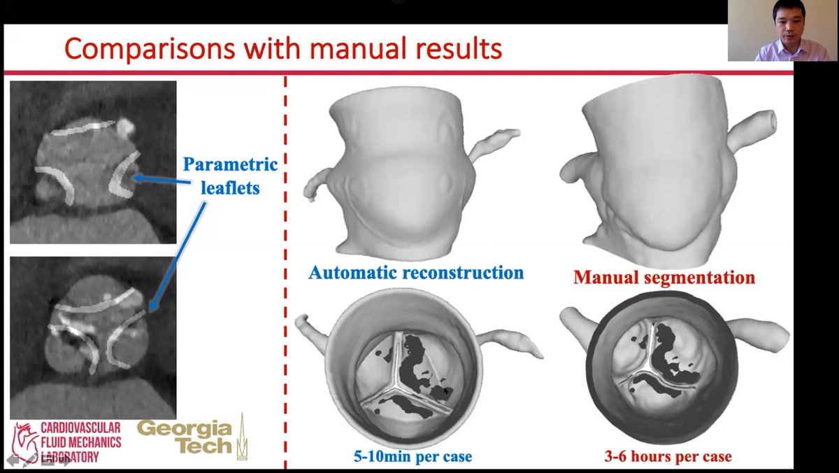 CFMLAB_GT's tweet photo. Nice talk from Dr. Huang Chen at #SB3C2021 on rapid automatic reconstruction of #heartvalves and cardiac structures from #CTimages for pre-#TAVR evaluations using a #parametric #leaflet model. https://t.co/P7Yu4C0IuP