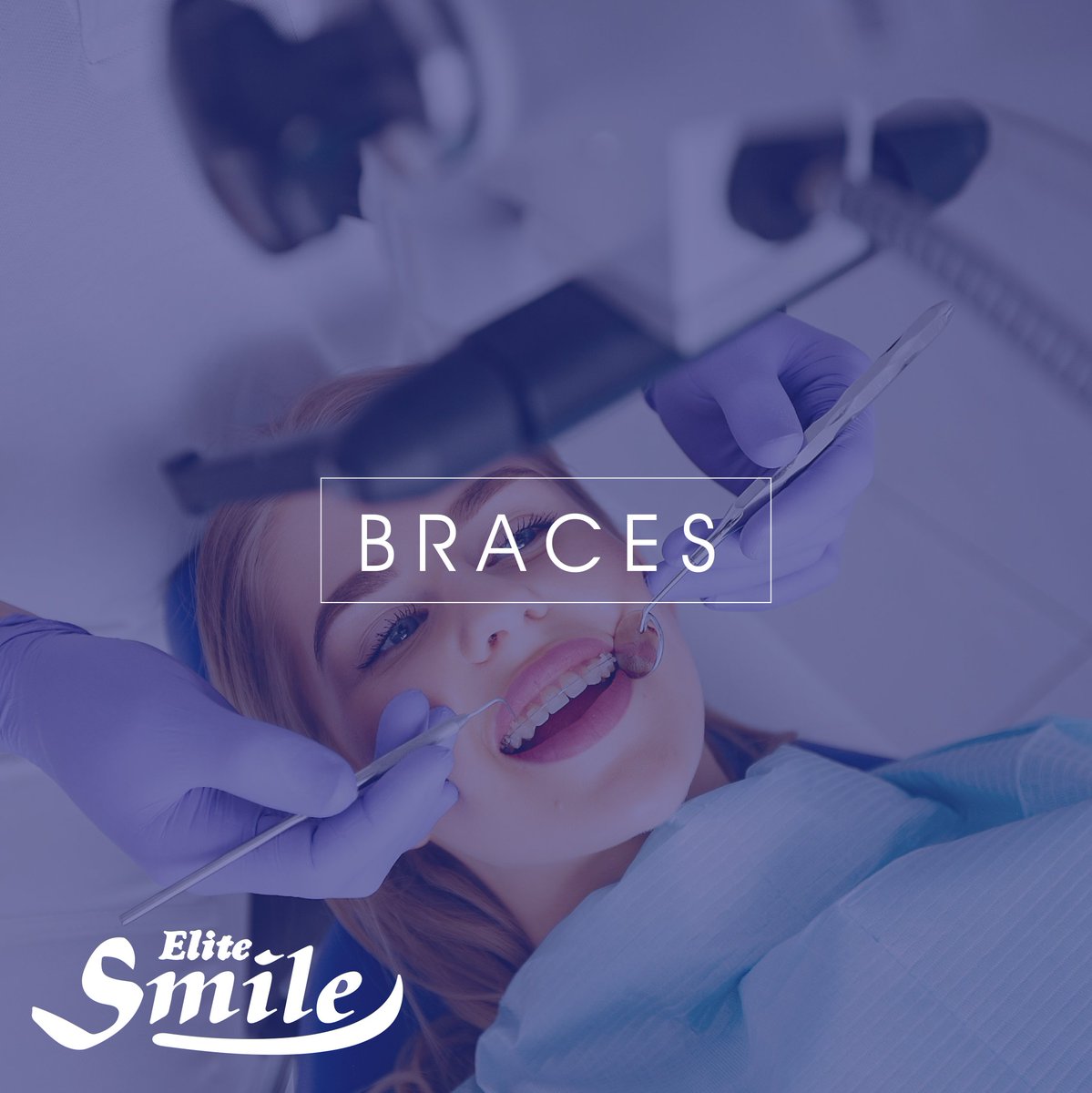 #ClearBraces: They move teeth in the same way traditional braces do, only without metal wires and brackets.

#TraditionalBraces: The bands are fixed around the teeth and are used as anchors while the brackets are most often bonded to the front of the tooth.

#braces #NJDentist