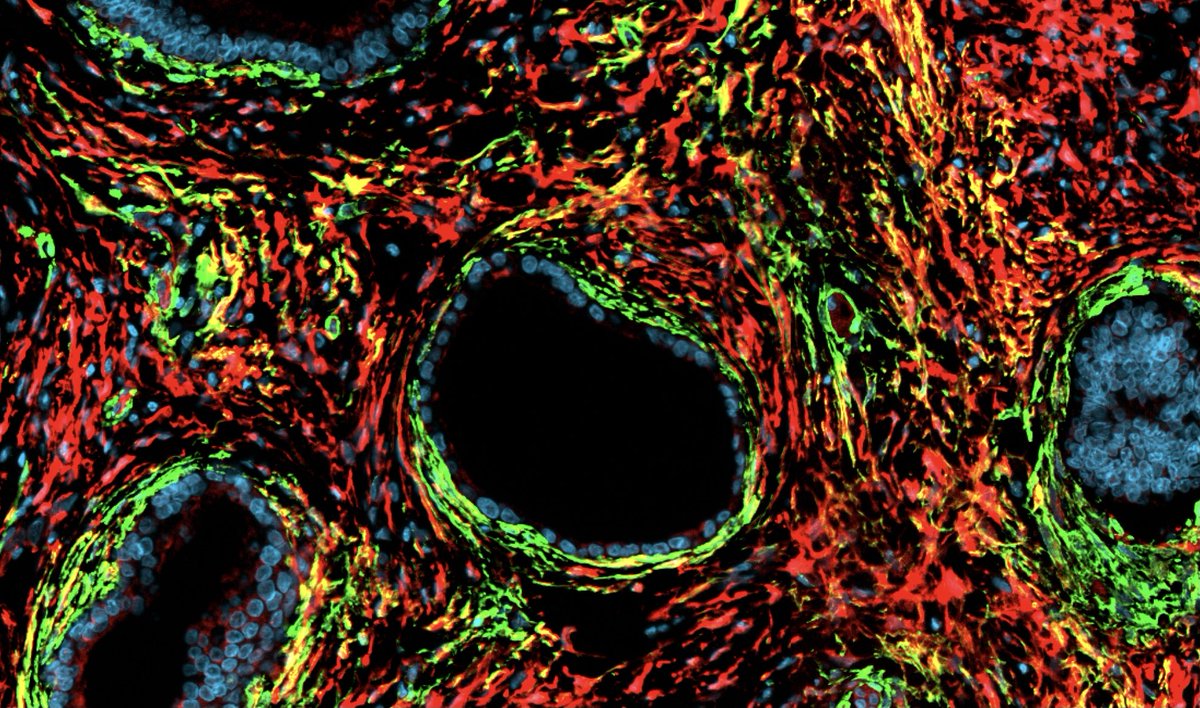 Mara Sherman Lab (@marashermanlab) on Twitter photo Are you seeking a postdoc position focused on the pancreatic TME? Do you like forests, glaciated peaks, and all the alternative “mylks” that ever happened? Consider joining the Sherman lab in Portland <a href="/OHSUKnight/">OHSU Knight Cancer Institute</a>! DM me if interested. Pls spread the word 😊🙏 Are you seeking a postdoc position focused on the pancreatic TME? Do you like forests, glaciated peaks, and all the alternative “mylks” that ever happened? Consider joining the Sherman lab in Portland <a href="/OHSUKnight/">OHSU Knight Cancer Institute</a>! DM me if interested. Pls spread the word 😊🙏