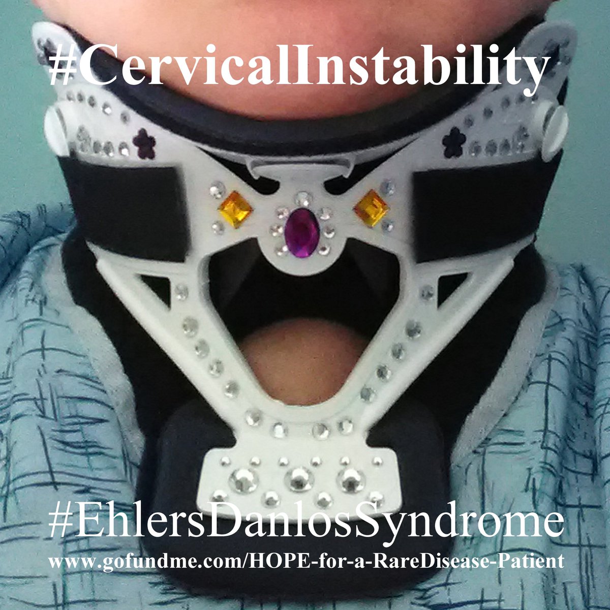 RarePatient's tweet photo. If your neck won't stay up and your brain is falling down, you need some sparkles.
https://t.co/rXPlg62BHX

#CervicalCollar #CervicalInstability #SubaxialInstability #ChiariMalformation💜 #EhlersDanlosSyndrome #Neurosurgery 

💔https://t.co/IZvd6VzgOY https://t.co/gZfMiQcJ5T