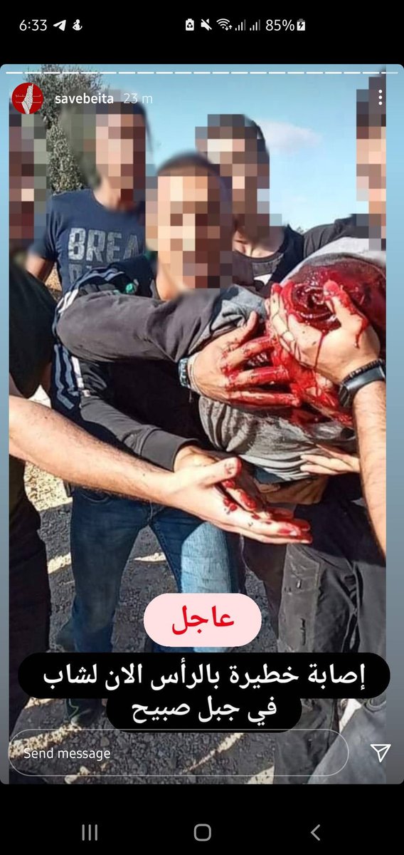 farawlah34's tweet photo. ليه محدش بحكي عن جبل صبيح !؟
اصابة خطرة لأحد الشباب بالرأس 
وانتو لسا ساكتين ومحدش بحكي بالموضوع
بؤرة استيطانية كبيرة ونكبة جديدة ولسا ساكتين!
#SaveBita
#انقذوا_جبل_صبيح https://t.co/Ak7eXX9wvy