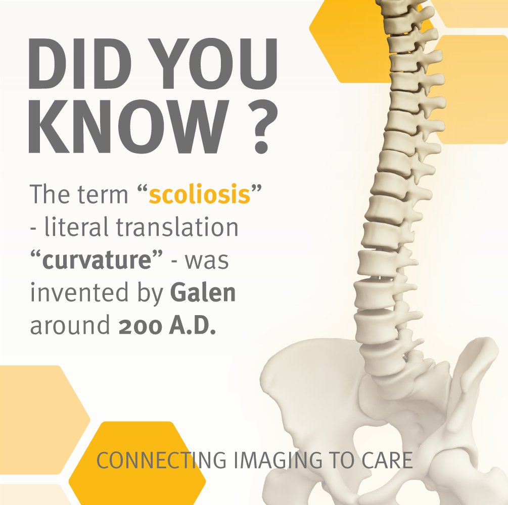 DID YOU KNOW ?

#scoliosisawarenessmonth #radiology #spinaldeformity
#funfacts #galen #wegotyourback