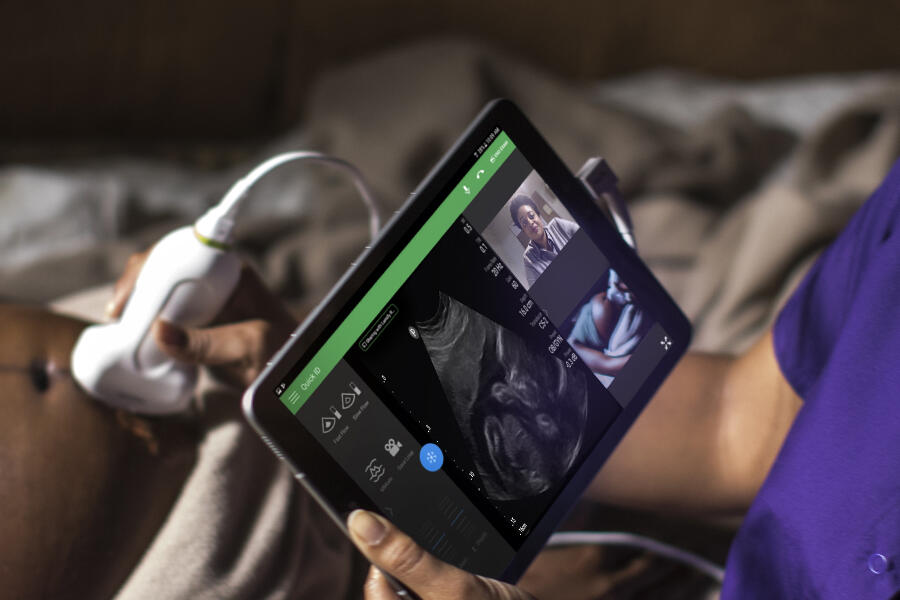 Bringing mobility to ultracompact ultrasound. Discovering how carts affect visibility, shareability, adoption and findability. Using carts to make breakthrough technologies simple to use and easy to love.