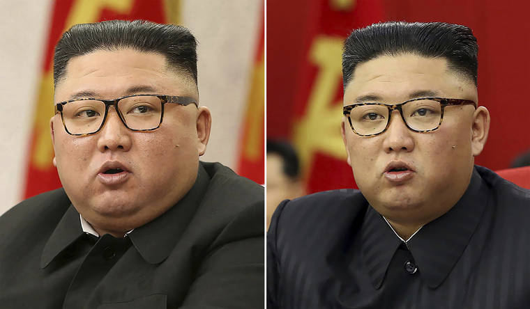 North Korea’s Kim Jong Un looks much thinner, causing health speculation