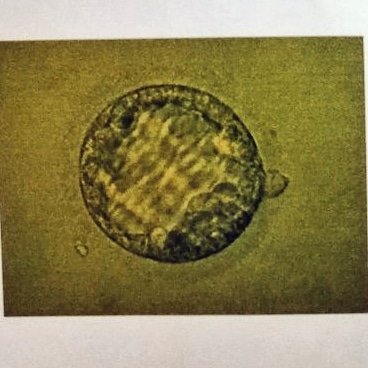 Hoy hace 1 año que nos reunimos con éste maravilloso embrión que hoy es nuestro bebé arcoiris de casi 4 meses, nuestro Vikinguito que nos hace la vida feliz (y cansada! 😅) Gracias al gran equipo de <a href="/ivfspain/">Ivf-spain</a> y al Dr Rogel por ayudarnos a cumplir nuestro sueño! ❤️❤️❤️