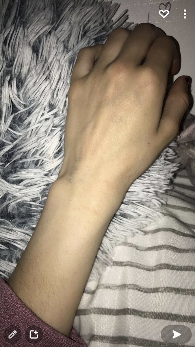 theartofpainn's tweet photo. teehee :3
37kg
#anorexia #thinspo #ana #anorexic #starvingforana #thin #probone #bonespo #bone #starving #skinnylove #skinnyteen #skinnygirl #ed #edtwt #edtw #eatingdisorder https://t.co/GMUyLQhT4Z