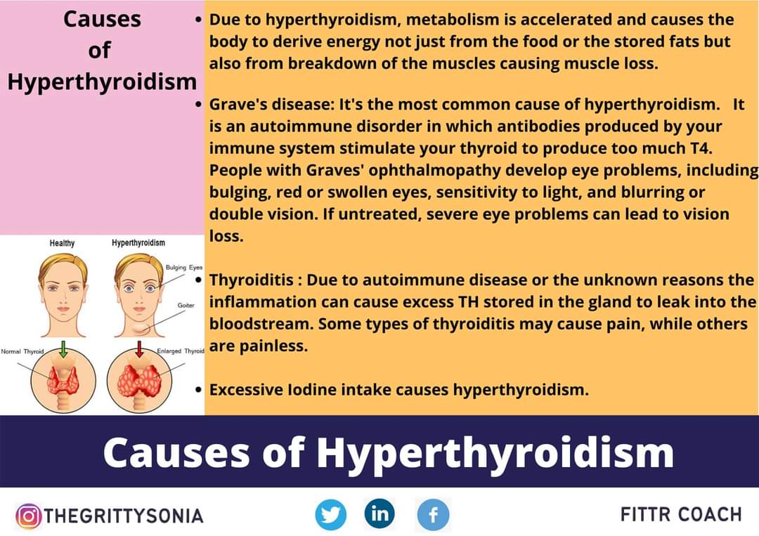 thegrittysonia's tweet photo. Hyperthyroidism is an autoimmune disease that affects d thyroid gland. It's a condition when TH r produced more than normal quantity. 
Medical intervention is must to treat  thyroidism.#fittr #fittrcoach #fittrmom #stayfitwithgrittysonia #hyperthyroidism #hormonalimbalance https://t.co/HbfNilZ78i