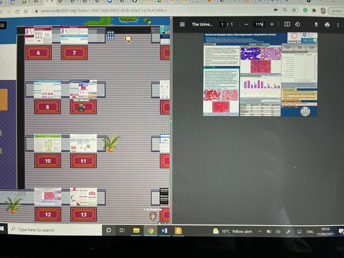 ibrahimSalsanie's tweet image. A wonderful experience at   #ECDP2021 congress, nice virtual venue , thanks for the organizers and speakers! @NormanZerbe @EloyCatarina @neopathology @sakhurram