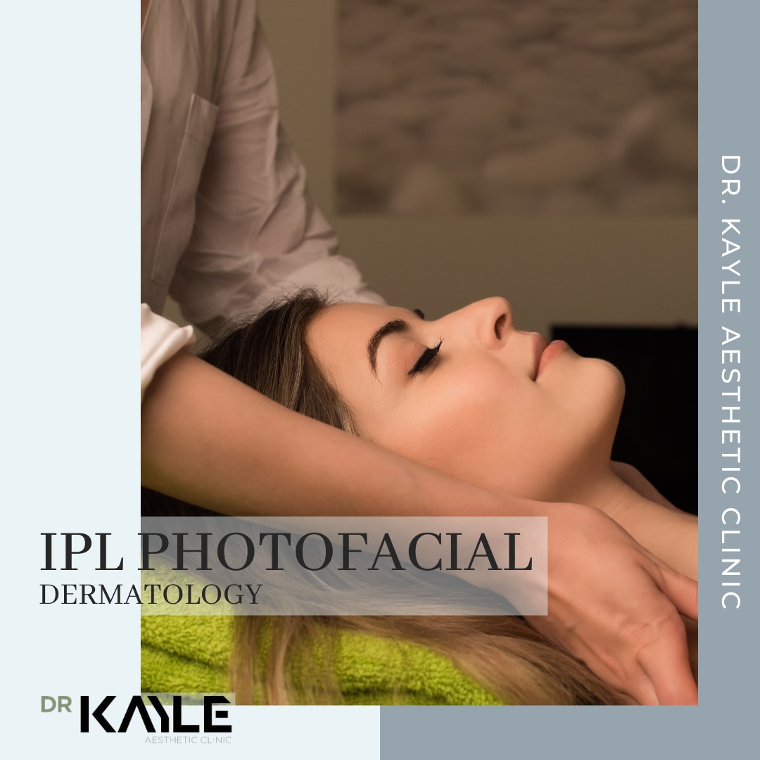 A #Photofacial, or Fotofacial, also known as #Photorejuvenation, is a #treatment touted to reverse sun damage, even out #facial color as well as improve tone and texture in the process.
Know more: tinyurl.com/DrKIPL

#drkayle #dubai #dubaiclinic #clinic #facial