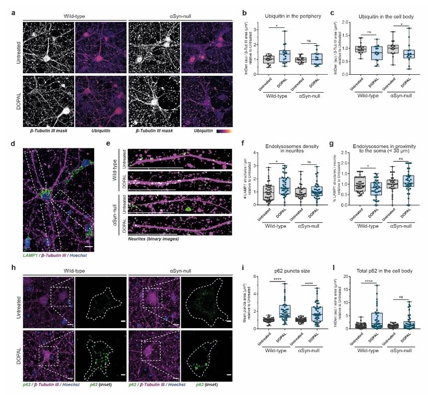 ScienceofPD's tweet photo. New @biorxivpreprint manuscript from @anna_masato @luigibubacco &amp; colleagues presents data that dopamine metabolite DOPAL initiates α synuclein-mediated impaired proteostasis in neuronal projections that may lead to enhanced vulnerability in #Parkinsons
https://t.co/2kkEvUTiyC https://t.co/Dc4rvFglr6