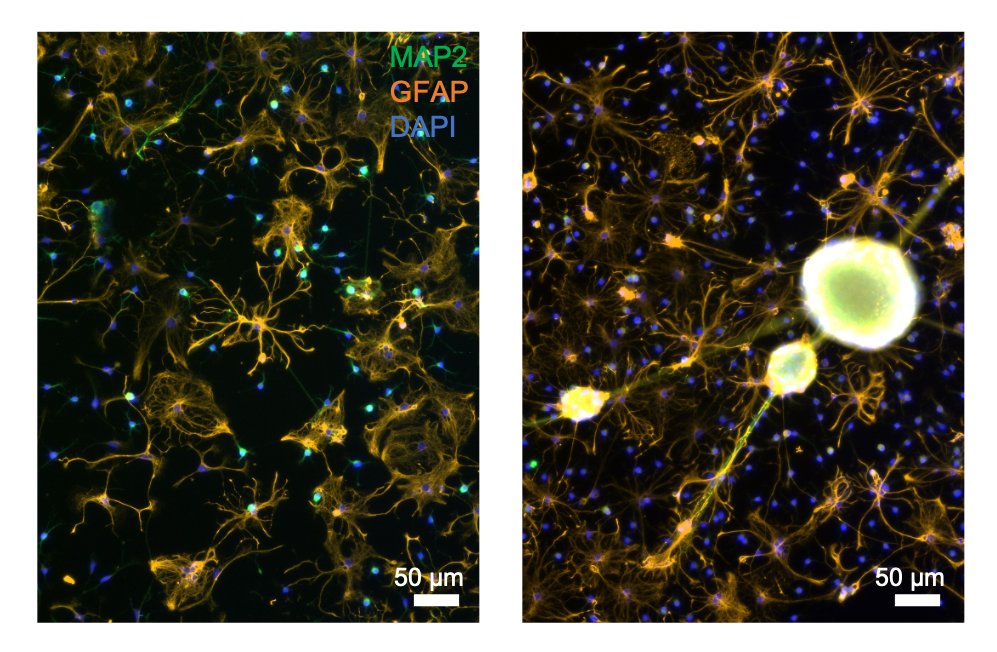 Jolien Pas (@pasjolien) on Twitter photo Excited about our latest results using primary cortical cells with #neurospheres on our devices! Work that started in the lab with <a href="/GeorgeMalliaras/">George Malliaras</a> and continued with <a href="/neurophoton/">Rod P. O'Connor</a> and Panaxium. Let's get these neurons to fire! #electrophysiology #CaImaging Excited about our latest results using primary cortical cells with #neurospheres on our devices! Work that started in the lab with <a href="/GeorgeMalliaras/">George Malliaras</a> and continued with <a href="/neurophoton/">Rod P. O'Connor</a> and Panaxium. Let's get these neurons to fire! #electrophysiology #CaImaging
