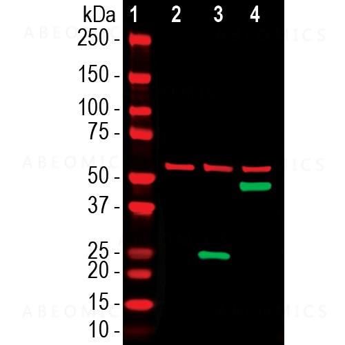 abeomics's tweet photo. Mouse monoclonal antibody to SARS-CoV2 (ACE2 binding domain) (Clone:2G1)

For more details visit our website - : https://t.co/bFpHF8acvs and follow the web-page : https://t.co/PHKpNLlN1j

#Monoclonal https://t.co/s257RvffcA