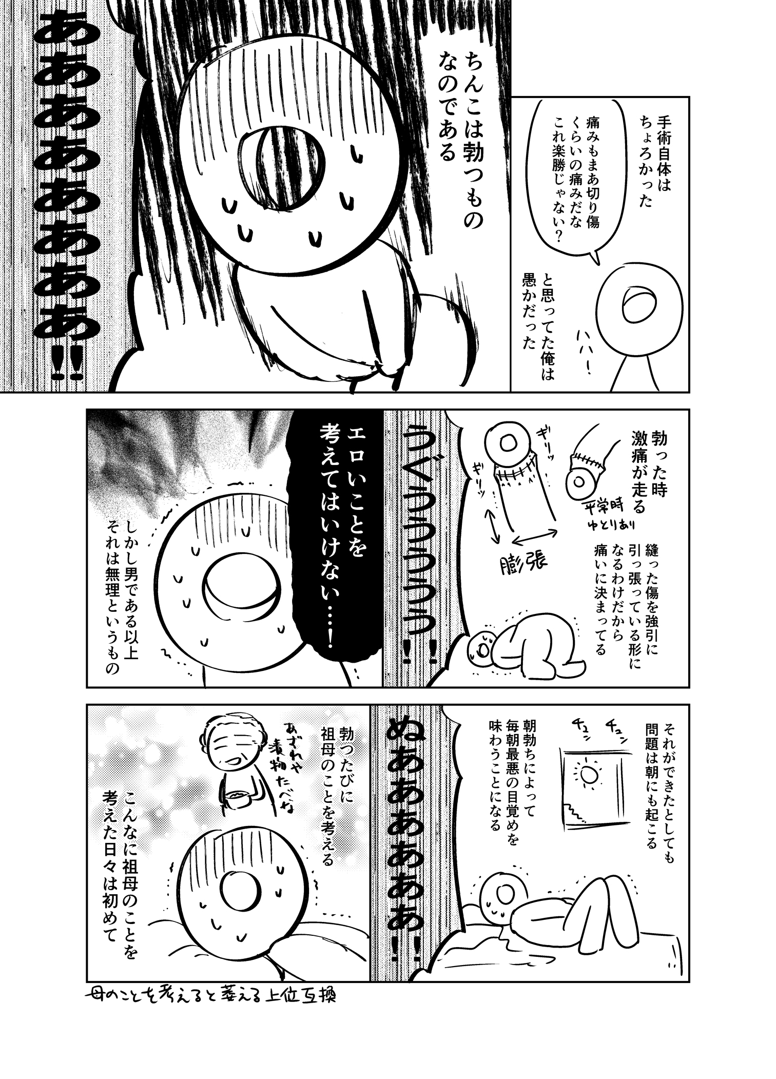 改造　ちんぽ画像 澄蓮@すみれ в X: „RT @azure_konno: 俺が受けた改造手術 包茎手術編 手術を受けようか悩んでいる方々の参考になれば幸いです。  受けたのはかなり前なので今は技術が進歩してるかも！ https://t.co/W7UOpxOciQ“ / X