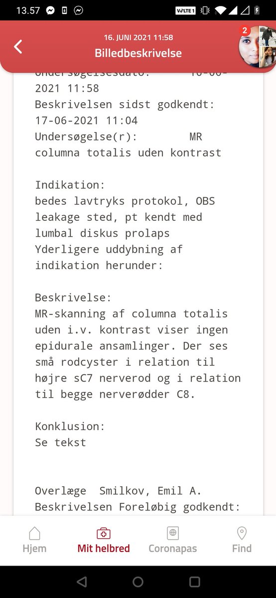 raresearchingdk's tweet photo. 😳😳

#radiology #medtwitter 

Cysts on the c7 nerve and c8 nerves. 

What the hell does this all mean ? Tarlov? 

If so then that means I've been right all along about my #csfleak 

#tarlovcysts #ScienceTwitter #Medstudent #Neurology #IIH #IIHWOP https://t.co/czBEZm1wgA