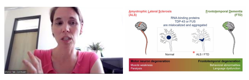 imbmainz's tweet photo. Today we learned how mislocalisation of RNA binding proteins leads to #neurodegenerativedisease.
Thank you to Dorothee @DormannL from @uni_mainz for your first talk at the Advanced Lectures as an #IPPMainz group leader! π #Ageing #Disease https://t.co/S3GjGqQBQq