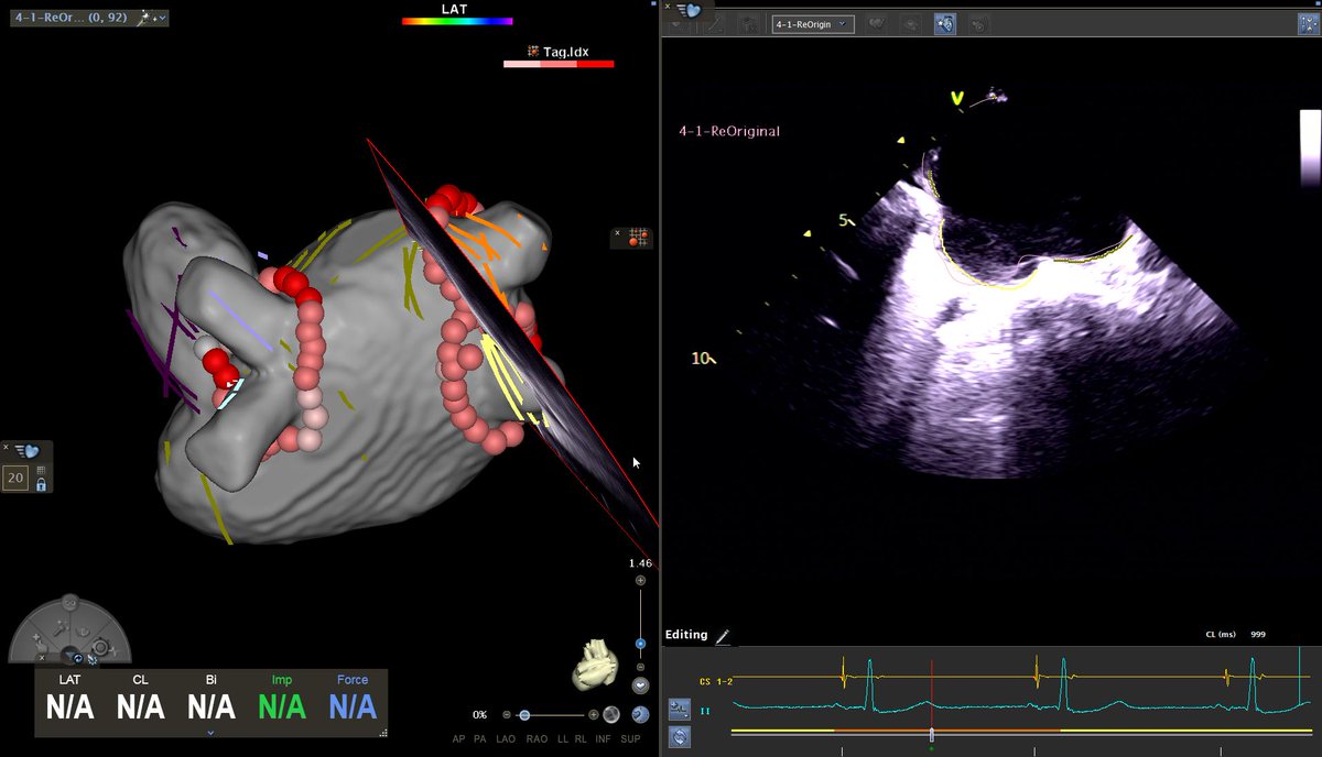 Finn Åkerström tweet media