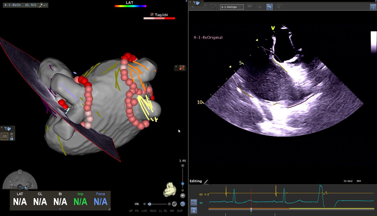Finn Åkerström tweet media