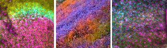 KerosuoLab's tweet photo. Genes in the embryo or flowers in a meadow, or both? By @ritamyazejian #labart #NeuralCrest #ChickEmbryo #HCR https://t.co/c79Fv7F8Z6
