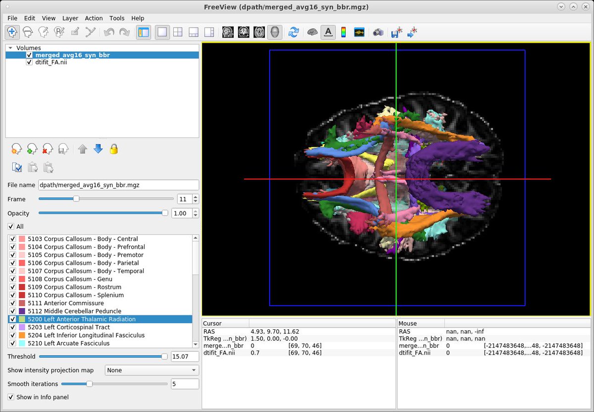 FreeSurfer (@freesurfermri) on Twitter photo Version 7.2 is coming! Are you ready? Lots of changes in TRACULA, incl. recon of 42 tracts trained on Connectom data. Check out the updated tutorial now to prepare:
surfer.nmr.mgh.harvard.edu/fswiki/FsTutor…
Summary of new features:
surfer.nmr.mgh.harvard.edu/fswiki/Tracula…
<a href="/chiaramff/">Chiara Maffei</a> <a href="/nastasiayendiki/">Anastasia Yendiki</a> <a href="/MGHMartinos/">MGH Martinos Center</a> Version 7.2 is coming! Are you ready? Lots of changes in TRACULA, incl. recon of 42 tracts trained on Connectom data. Check out the updated tutorial now to prepare:
surfer.nmr.mgh.harvard.edu/fswiki/FsTutor…
Summary of new features:
surfer.nmr.mgh.harvard.edu/fswiki/Tracula…
<a href="/chiaramff/">Chiara Maffei</a> <a href="/nastasiayendiki/">Anastasia Yendiki</a> <a href="/MGHMartinos/">MGH Martinos Center</a>