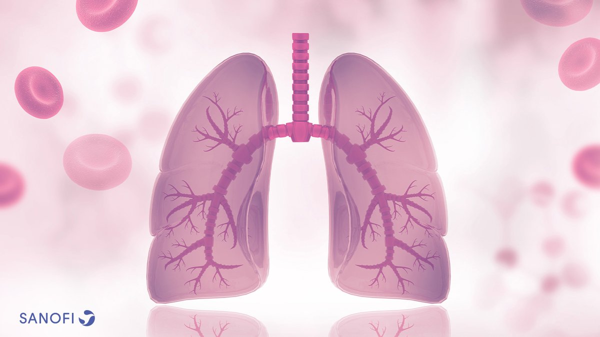 SanofiES's tweet image. ➡️El #AsmaGrave es un tipo de #asma que resulta difícil de controlar.

L@s pacientes pueden presentar síntomas persistentes y con tendencia a manifestarse frecuentemente.

👉Descubre más ℹ️ en bit.ly/3cxZLZc

#SanofiEsRespiratorio