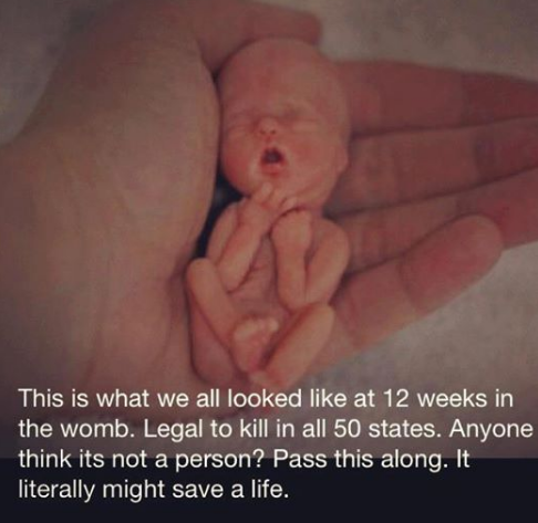 Gospa_Messages's tweet photo. Baby at 12 weeks https://t.co/1RsFKXhhZT