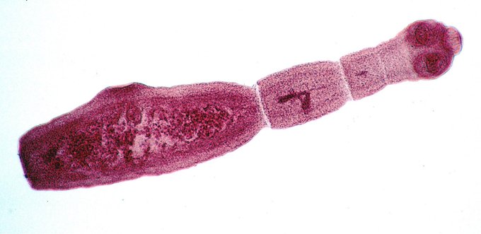 The parasite Echinococcus multilocularis takes the form of a tiny tapeworm in canines, but can cause a growth in the liver of humans that causes serious and potentially deadly health complications. (Photo: Wikimedia Commons)
