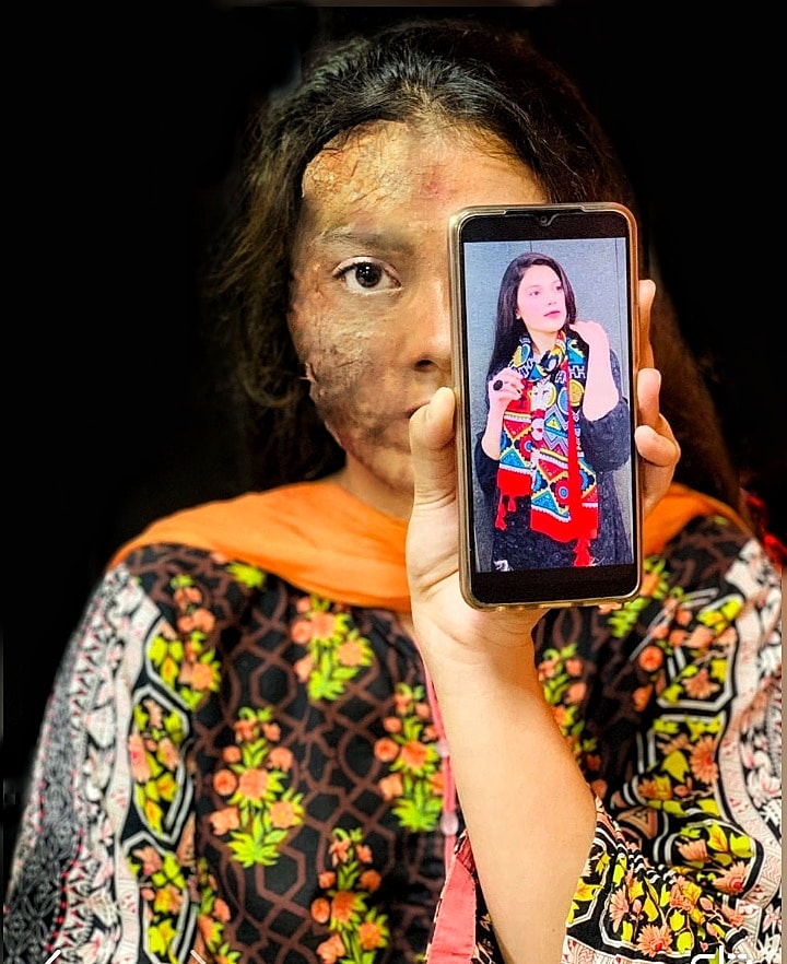 Shanakht1's tweet photo. It takes years to build a life but only seconds to ruin it.
.
.
.
#shanakht #shanakhtofficial #sochbadlegitomuashrabadlega #pakistan #acidattack #acidattackawareness #awareness #socialawareness #socialwelfare #onlineawarenesscampaign #stopacidattacks #freedomforwomen https://t.co/gGBQoolf6b