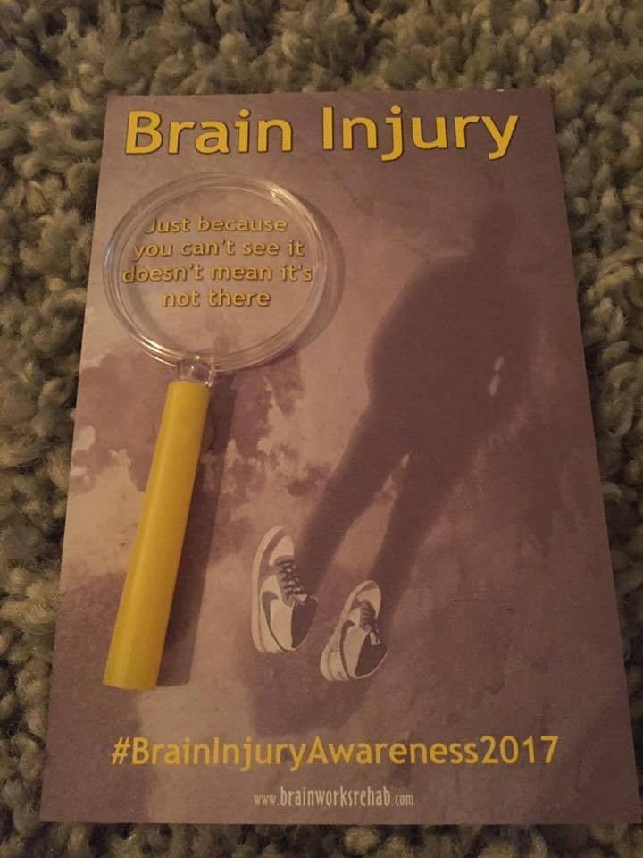 Brainworks tweet media