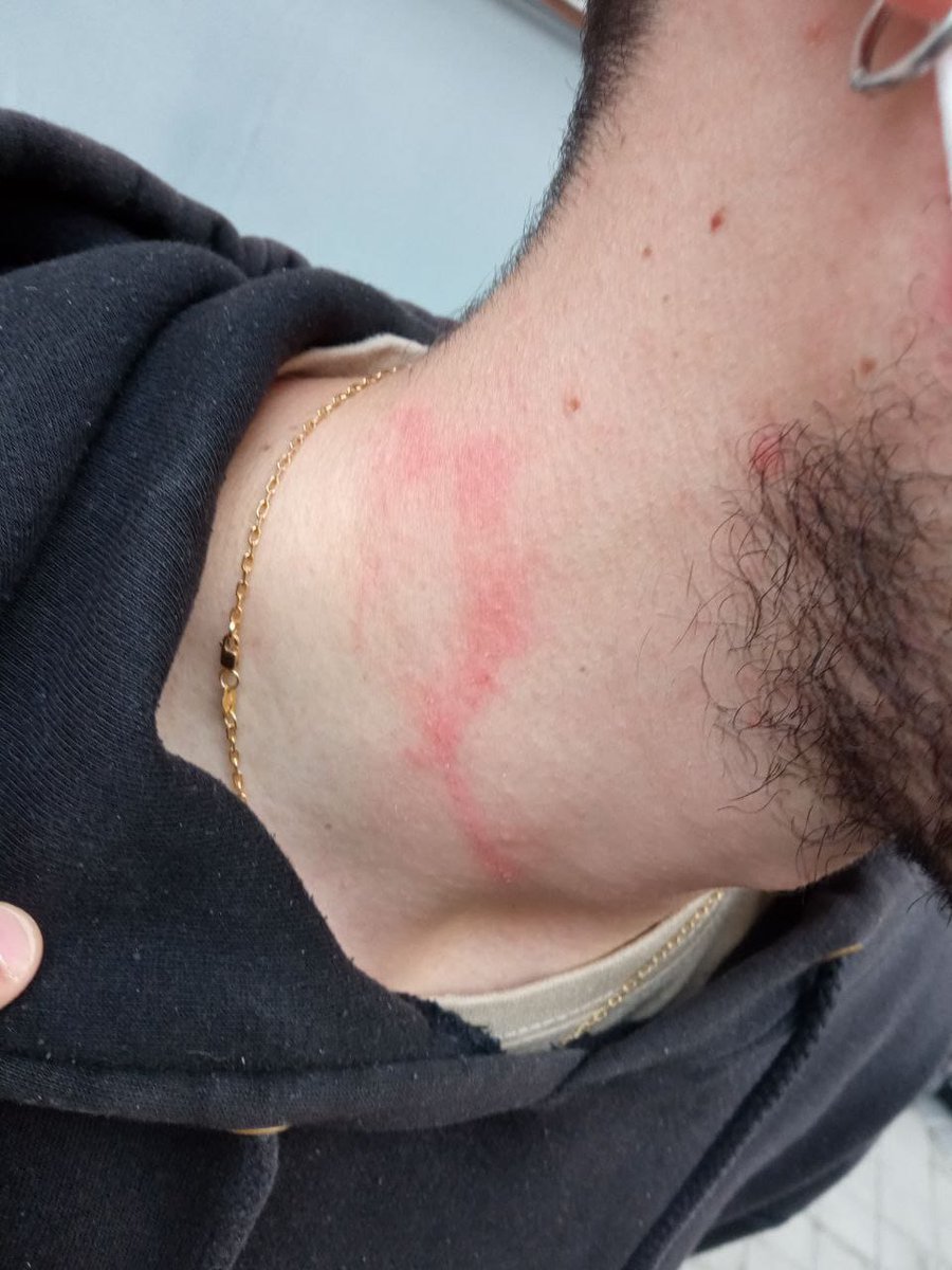 Nos han apaleado para sacar a una familia de su casa!