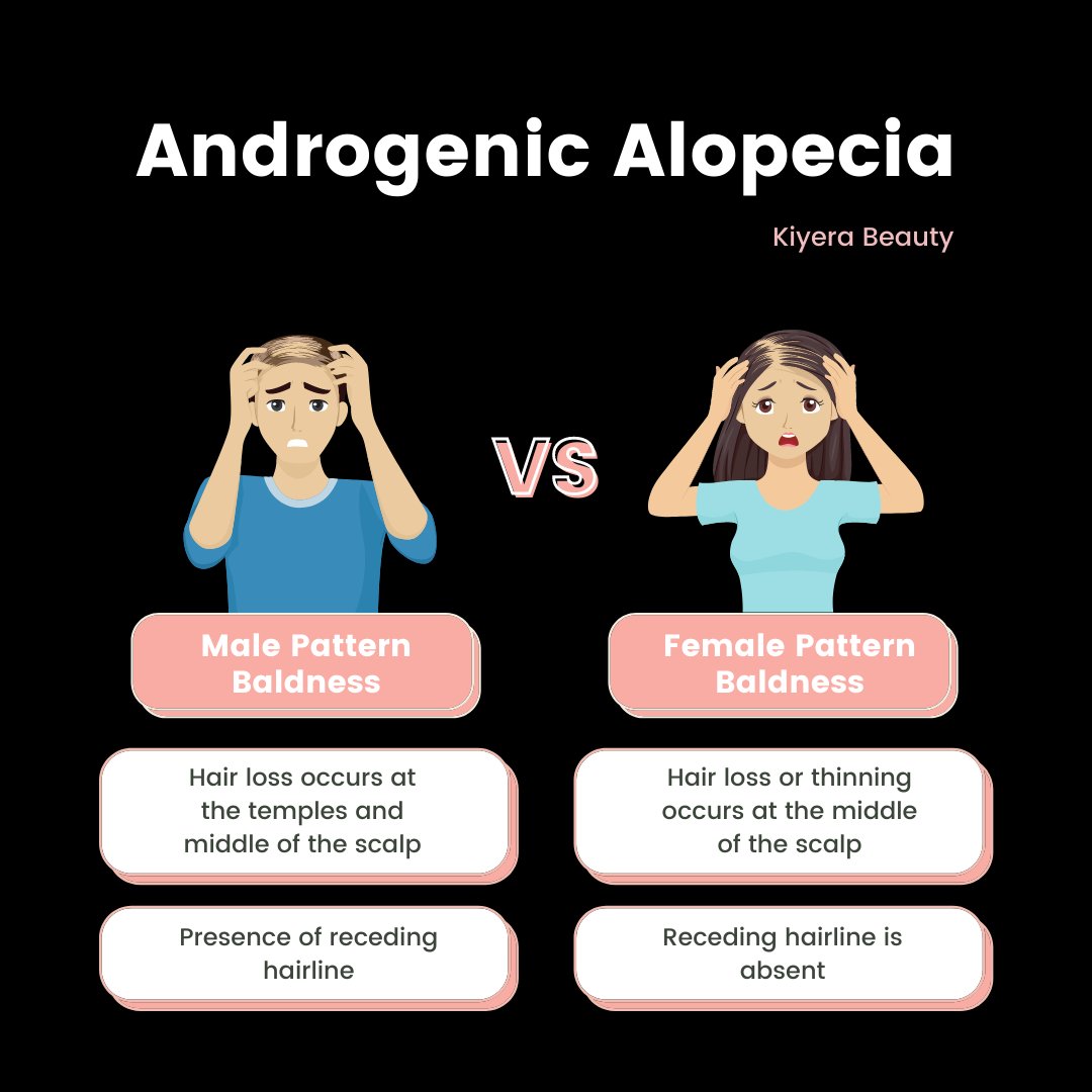 kiyerabeauty's tweet photo. Androgenic alopecia can affect both men and women, however, the the traits of both #malepatternbaldness and #femalepatternbaldness differs from one another. Here are the key differences between the two.
.
Share and Retweet!
.
#androgenicalopecia #alopecia #hairloss #hairtwitter https://t.co/fE8R2haJs2