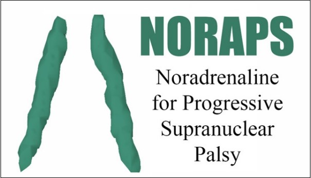 CambridgeFTD's tweet photo. Very excited to have recruited the first participants into our phase II clinical trial @NorapsTrial to treat apathy &amp; impulsivity in progressive Supranuclear Palsy. Progress on the long road from basic science to better care
 #Atomoxetine #PSP #CCPP #Apathy @CambridgeBRC @mrccbu https://t.co/JmM8amSBJm