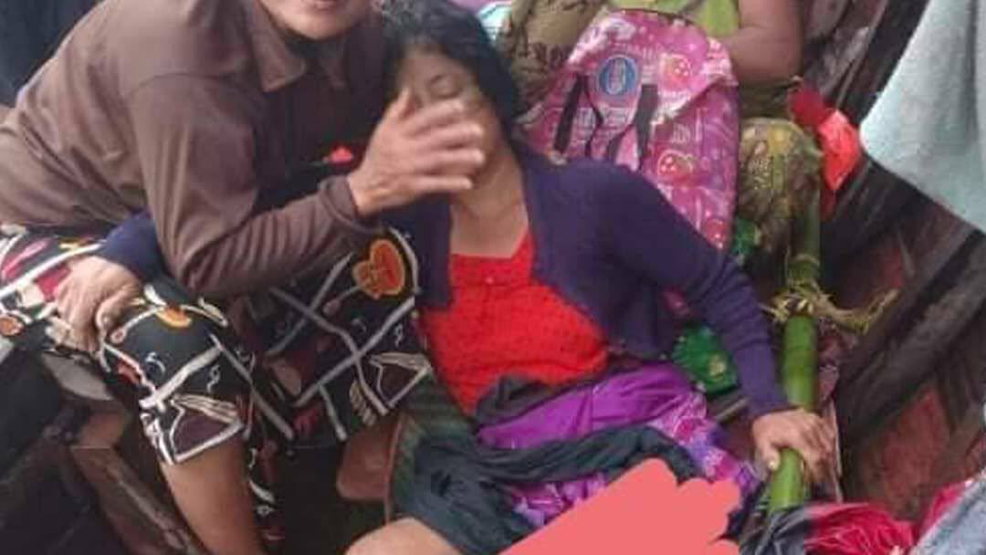A 49 years old women named Daw Aye Mya, injured from a landmine set by Junta terrorists in Kyauk Taw Tsp, Rakhine State, yesterday. #June18Coup #WhatsHappeningInMyanmar
