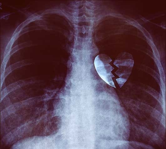 caption this (@alintilayalim) on Twitter photo 