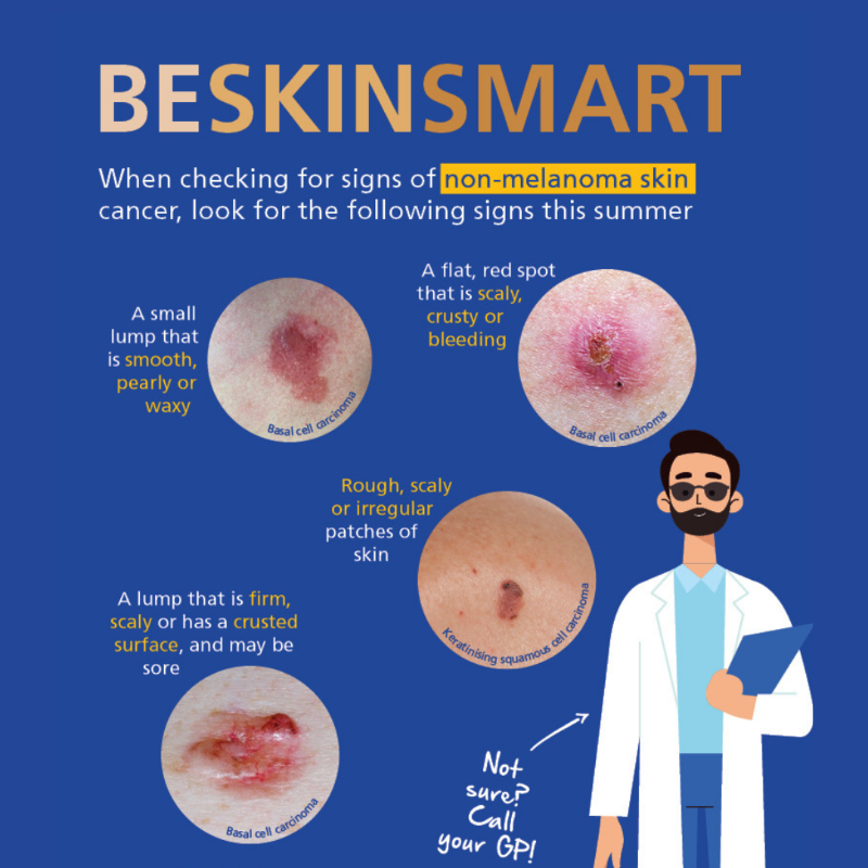 IrishCancerSoc's tweet photo. Most skin cancers are caused by skin damage that happens from exposure to the sun. 🌞 The damage can happen over a long period of time or from getting sunburnt. 

Be #SkinSmart and know the signs of skin cancer.
