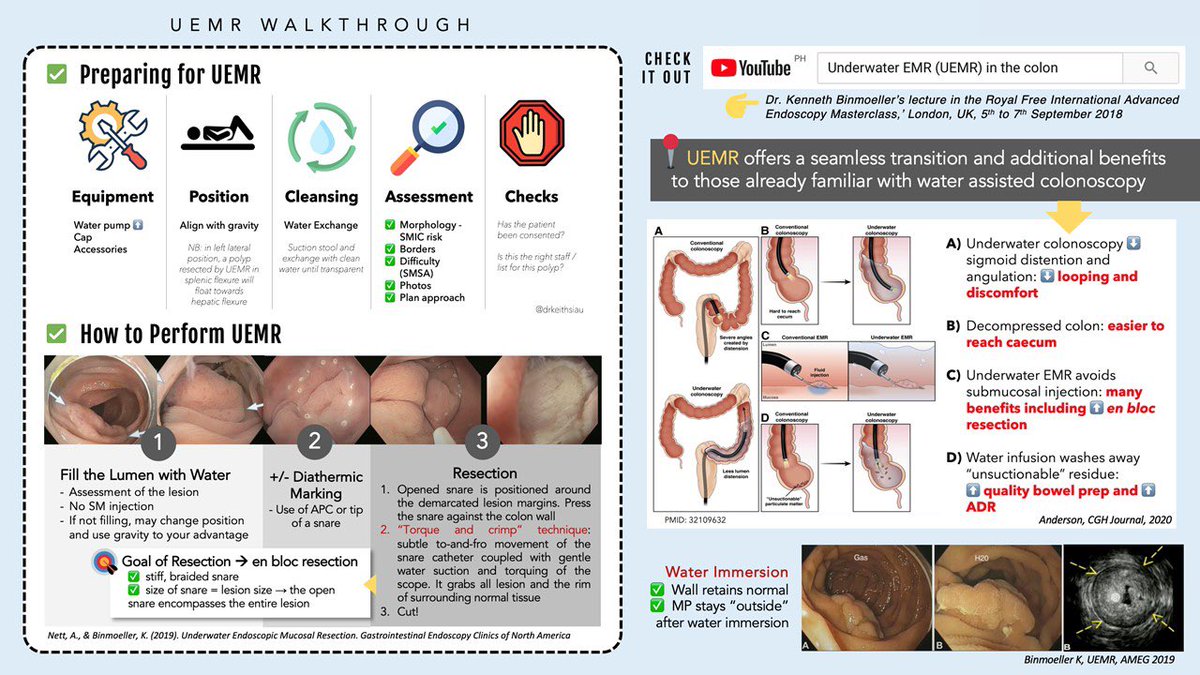 ScopingSundays's tweet photo. Missed out on the 🔥🔥🔥#ScopingSundays discussion this weekend on “Underwater EMR”?

Check out the #ScopingSummary from the interactive discussion led by @SunilAminMD, @KM_Pawlak &amp; @drkeithsiau!

Special thanks to @enrrikke for the summary #GIRecap! https://t.co/gR8sHa1bxq